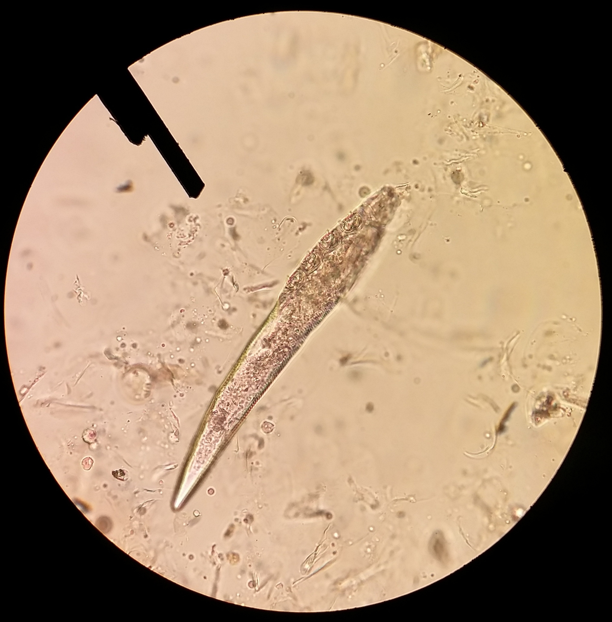 demodex Milbe Labor Mikroskop Pinzette